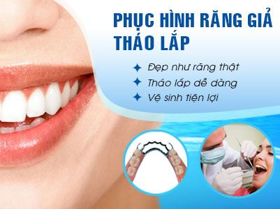 Răng Tháo Lắp | Phục Hình Răng Tháo Lắp