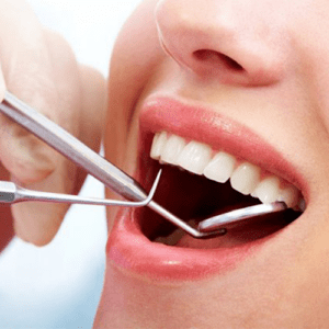 Viêm nha chu | Điều Trị Nha Chu