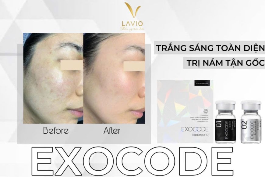 Laravan spa Lavio spa & Clinic Trị nám, trị mụn và tắm trắng công nghệ cao tại Cần Thơ